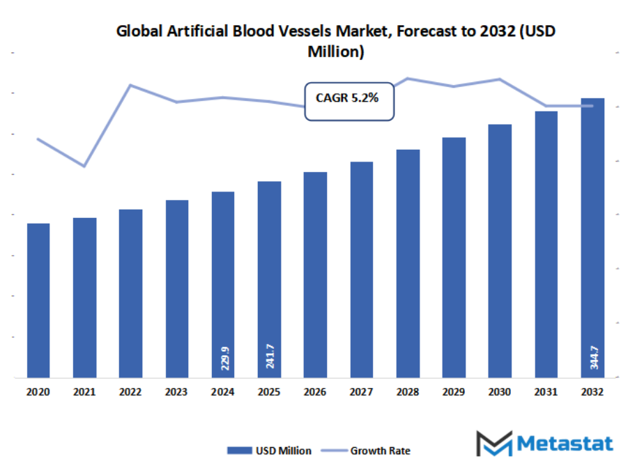 Artificial Blood Vessels Market Size By Value
