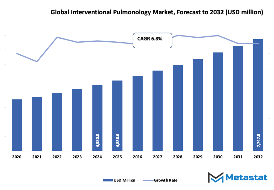 Interventional Pulmonology Market Size By Value